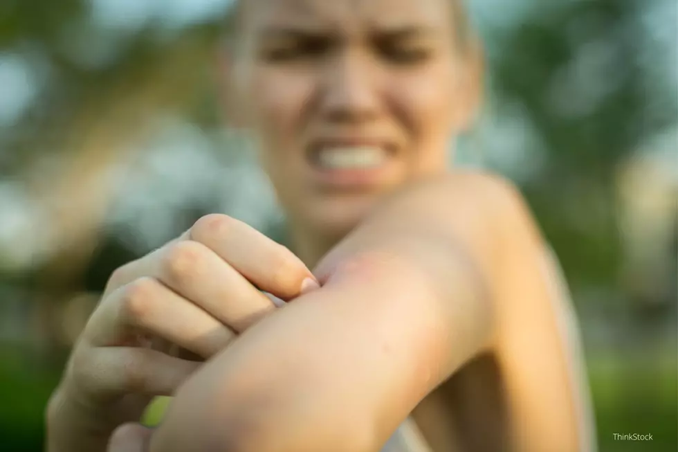4 of the Best Ways to Keep Pesky Insects at Bay in Minnesota